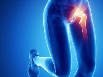 X-ray-style image of the groin area for diagnostic examination.