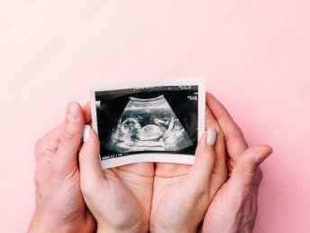 A couple holding NT (Nuchal Translucency) and NB (Newborn) scan films in both their hands.