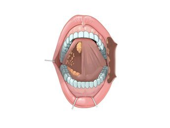 Ultrasound image of the salivary glands for diagnostic examination.