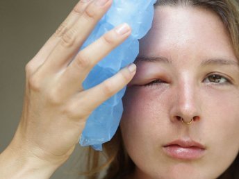Image showing post-traumatic swellings on a patient's extremity